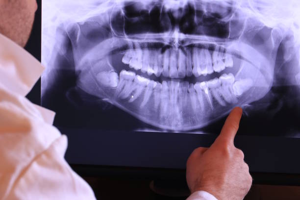 Best Emergency Dental Services for Seniors in Wonder Lake, IL
