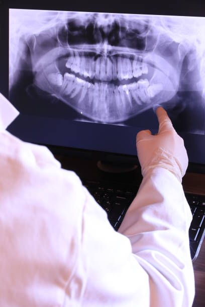 Best Emergency Dental Extractions in Wonder Lake, IL