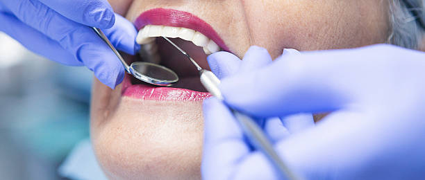 Best Mobile Emergency Dentist in Wonder Lake, IL
