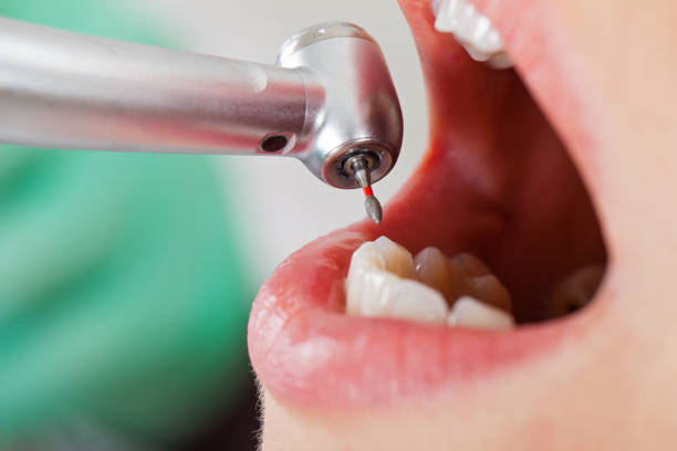 Best Emergency Dentist for Lost Fillings or Crowns in Wonder Lake, IL